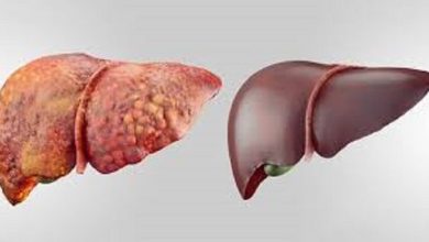 جلوگیری از پیشرفت بیماری کبدی با داروی دیابت