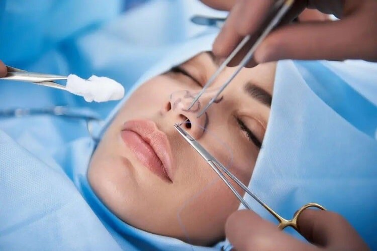 افزایش شکایات از جراحیهای زیبایی